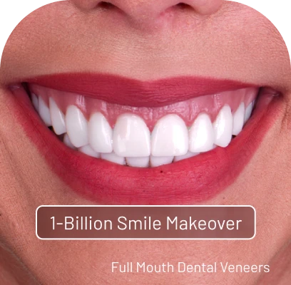 Woman's close-up smile after makeover, displaying perfect, white, and confidently aligned teeth.