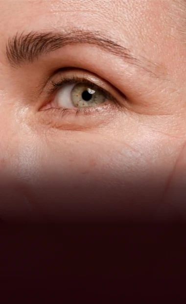 Blepharoplasty (eyelid surgery) results in San Miguel de Allende, rejuvenating eyes through advanced cosmetic facial procedures in Mexico.