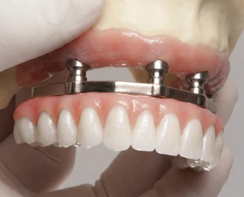 Smiling patient with restored confidence after procedure with dental implants