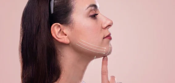 Side profile example of sliding genioplasty results areas to treat