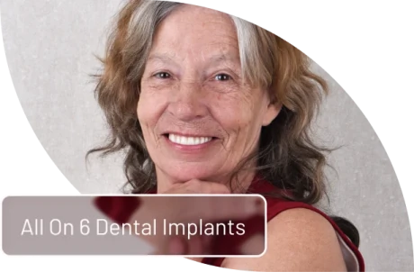 Patient smiling after full-mouth restoration with All on 6 dental implants in Mexico.