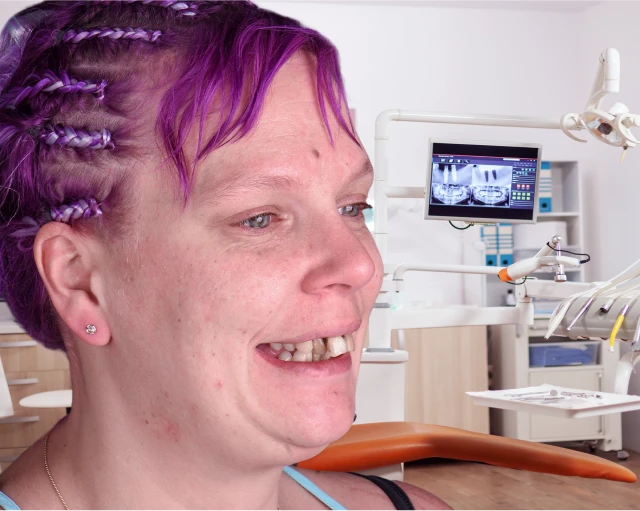 patient with uneven teeth smiling warmly before her full smile restoration
