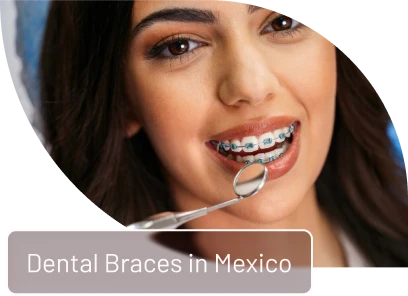 yound lady showing her teeth with braces