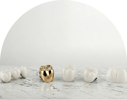 Middle-aged woman smiling confidently, showcasing her beautifully restored smile with natural-looking dental crowns.