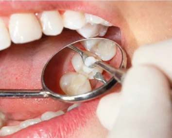 Smiling patient with restored confidence after procedure with dental implants