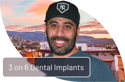 Patient smiling confidently after receiving full-mouth 3-on-6 dental implants in Mexico, showcasing restored teeth