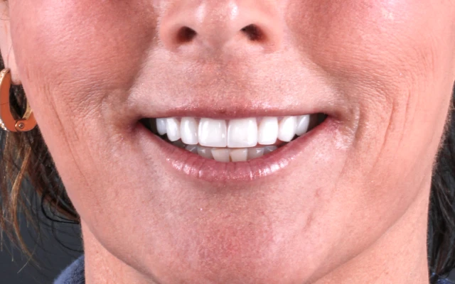 close-up shot of a confident and natural smile
