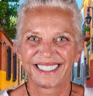 Senior woman smiling naturally, showing dental prosthesis anchored with mini implants.