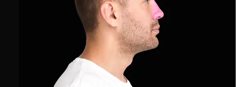 Nasal surgery for sleep apnea in San Miguel de Allende, addressing how to treat sleep apnea.