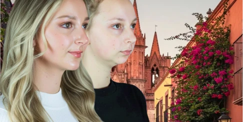 before and after, treatment 3 on 6 implants in San Miguel de Allender