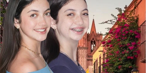 before and after, treatment snap on dentures in San Miguel de Allender